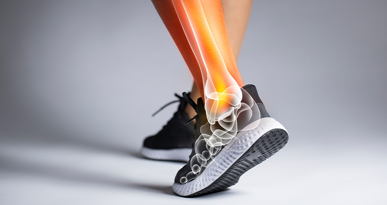 Orthopädie-Schuhtechnik - Benötigen Sie individuell angepasste Schuhe, Einlagen oder andere orthopädische Hilfsmittel? Orbisana Healthcare hilft Ihnen gerne!